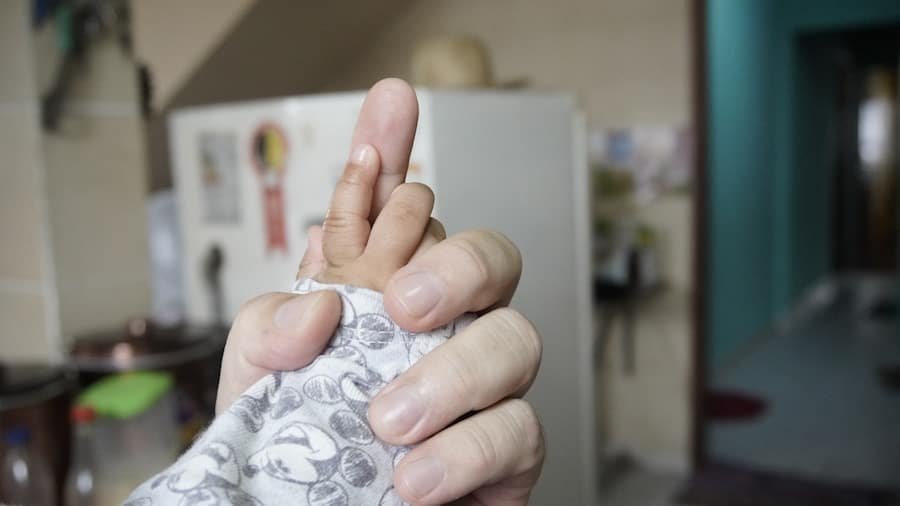 Photo "¿Puede ser beneficiosa la dieta cetogénica para personas con condiciones neurológicas y qué se debe considerar al implementarla?"
