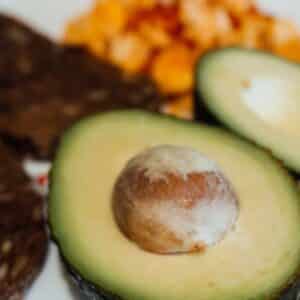 Photo What is a Ketogenic Lifestyle?