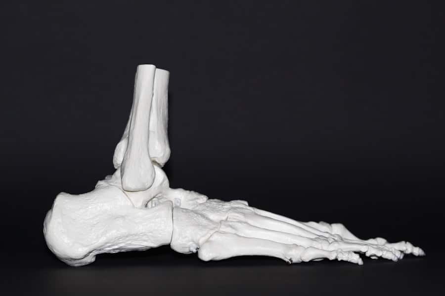 Photo "What is the Impact on Joint Health?"
