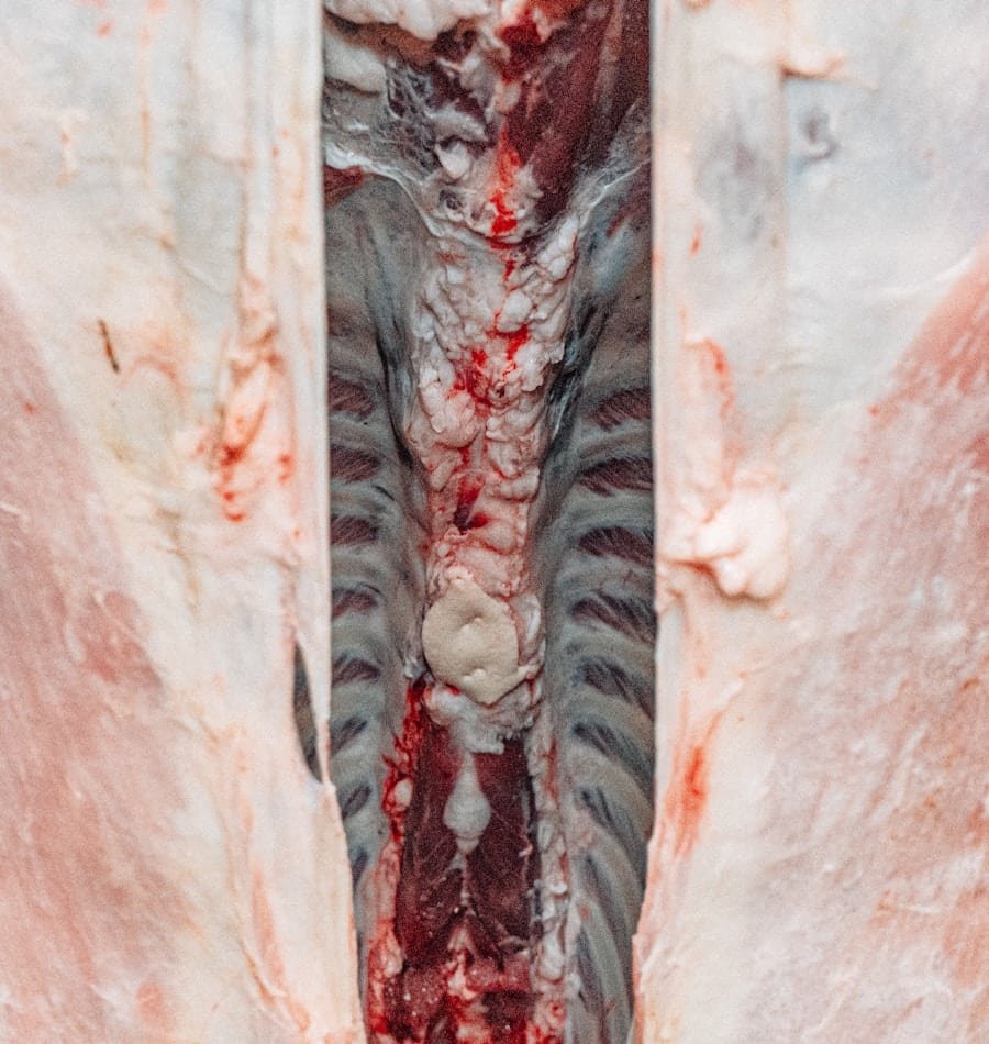 Photo "What Happens to Bone Marrow?"