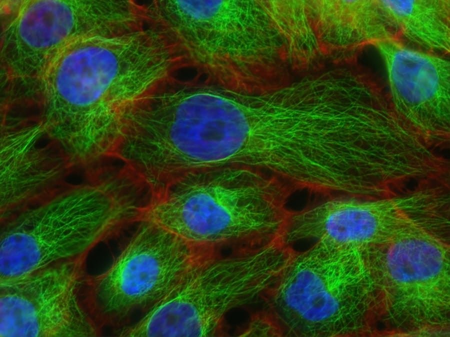 Photo "How Does Keto Affect Cellular Autophagy?"