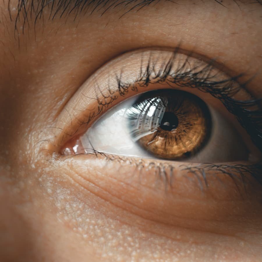 Photo "Can Keto Help with Dry Eyes?"