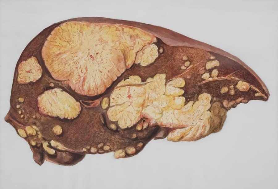 Liver Stress