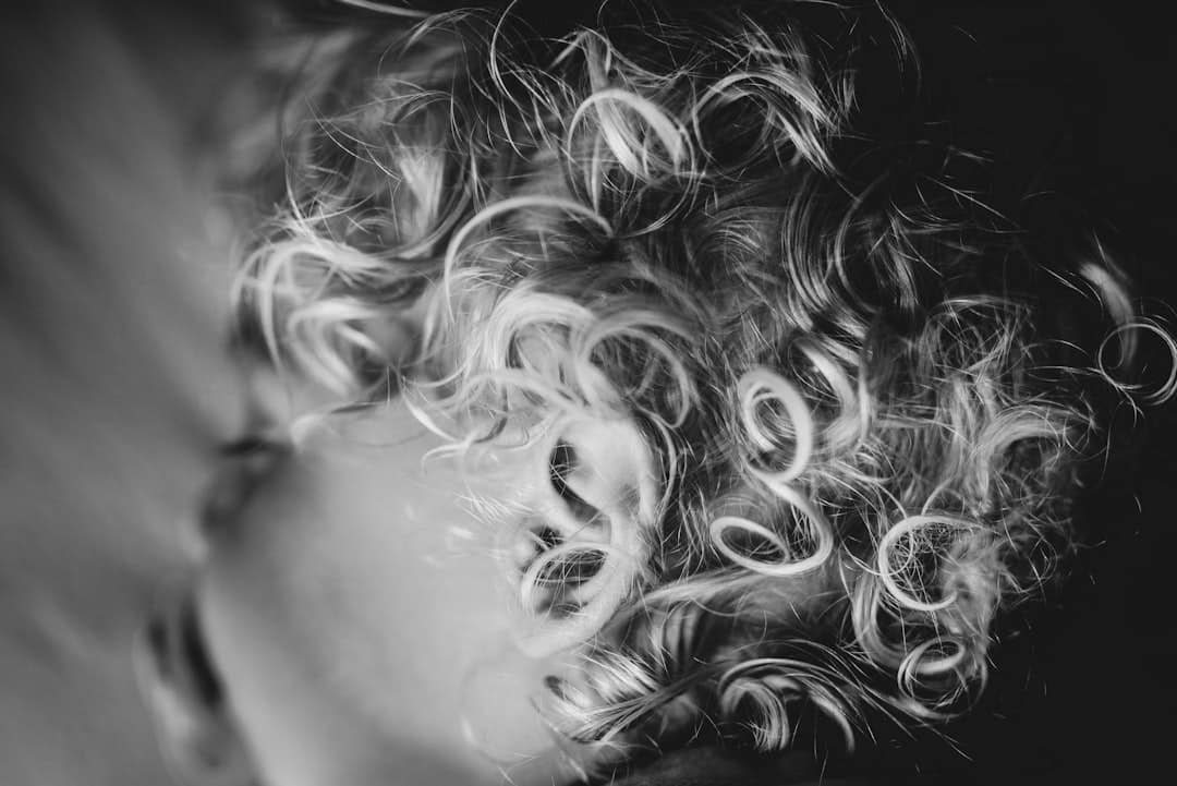 Photo Keto Hair Loss Recovery