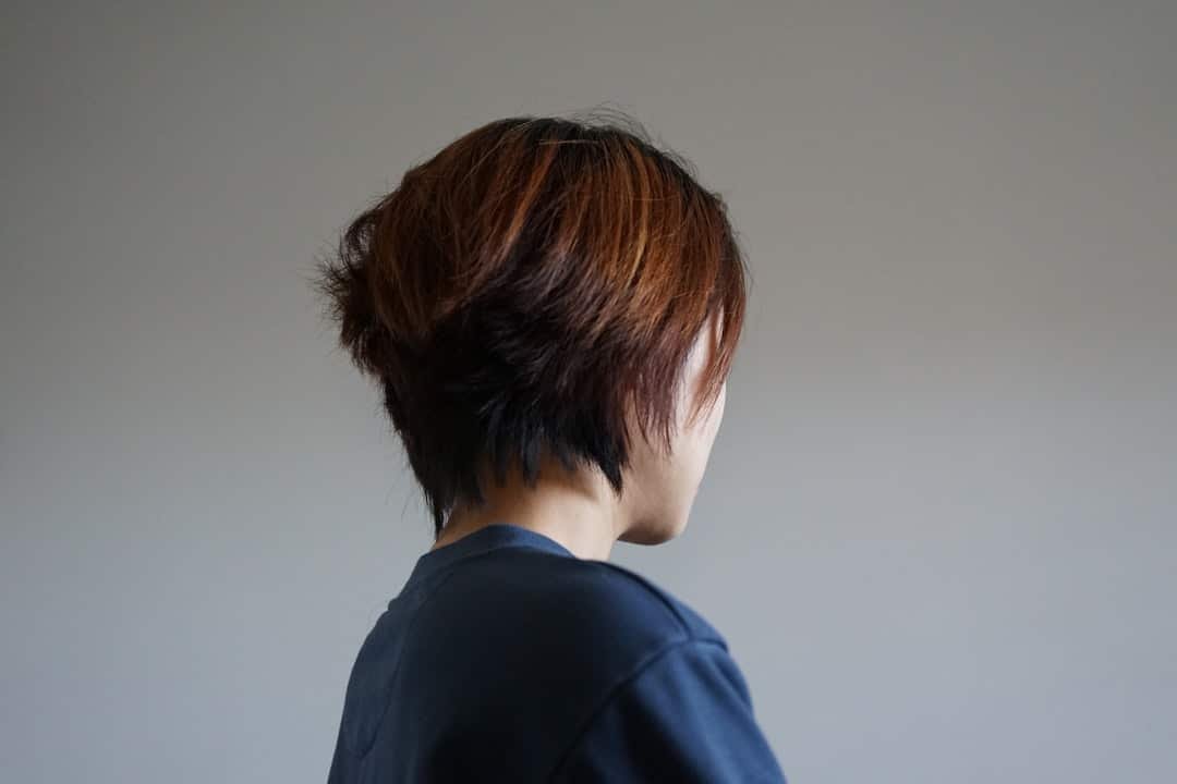 Photo Keto Hair Loss