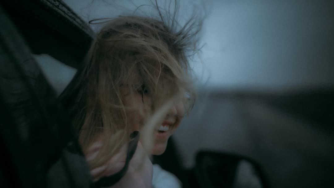 Photo Hair Falling out on Keto