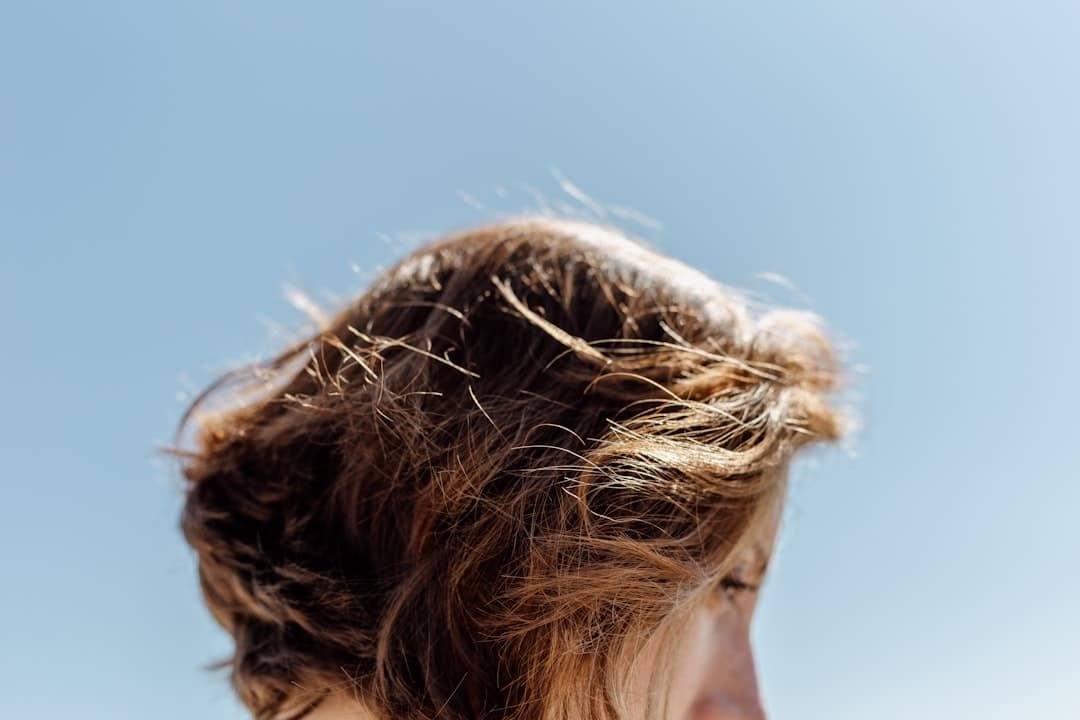 Photo Hormonal Hair Loss
