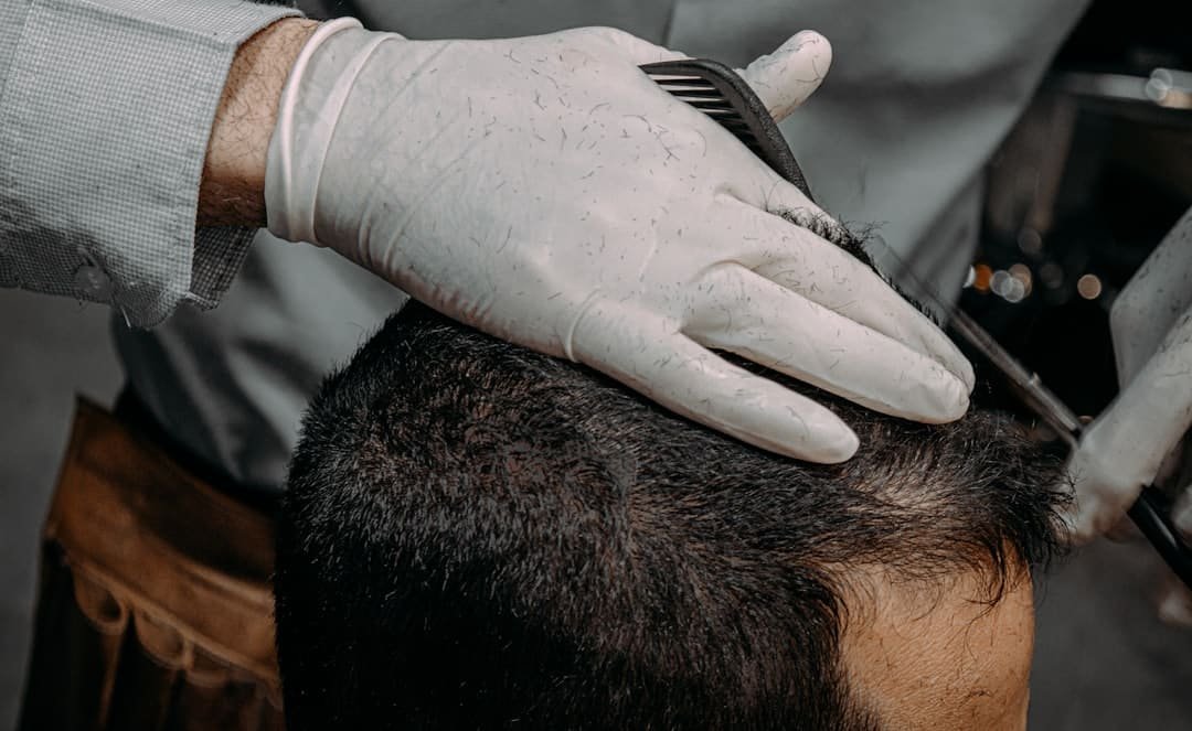 Photo Hair Loss After Starting Keto