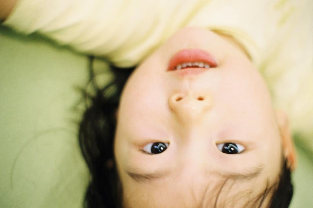 Photo Keto Childhood Epilepsy Syndromes