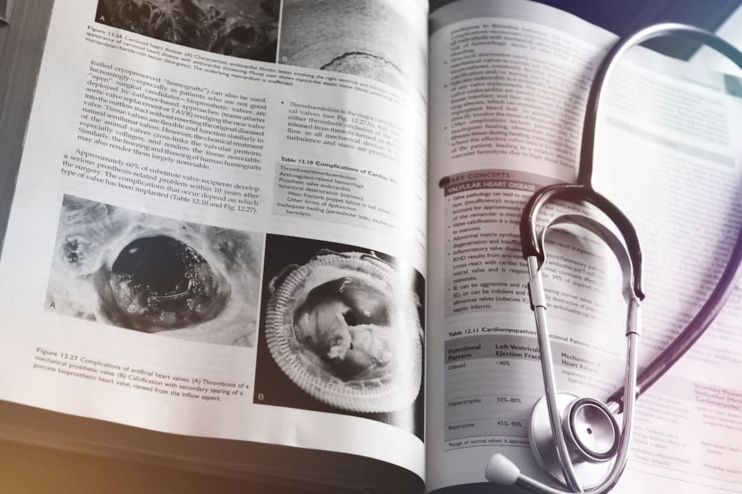 Photo Epilepsy Keto Diet Pdf