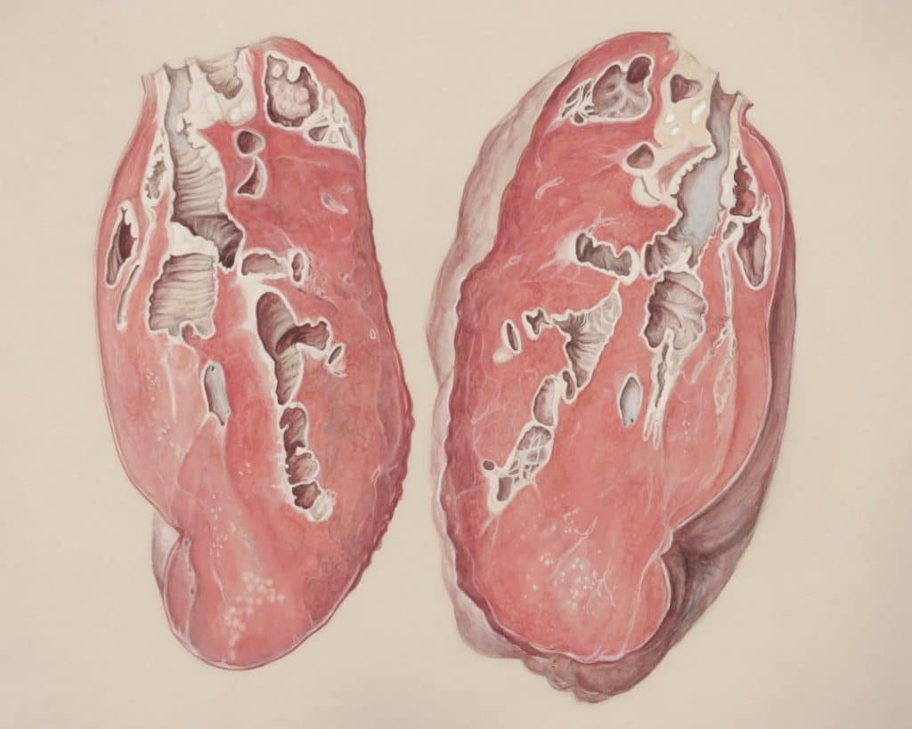 Photo Liver Stress