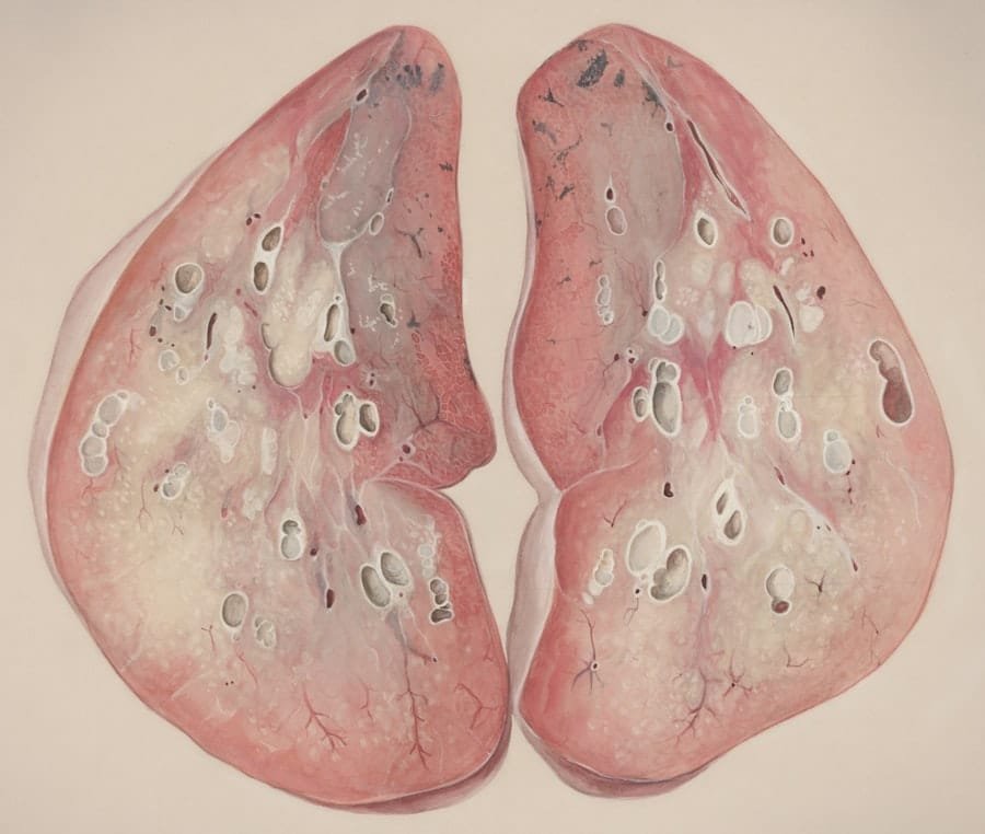 Photo Liver Stress