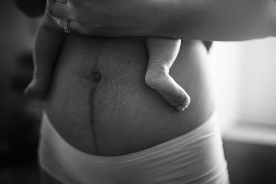 Photo Postpartum Weight Loss